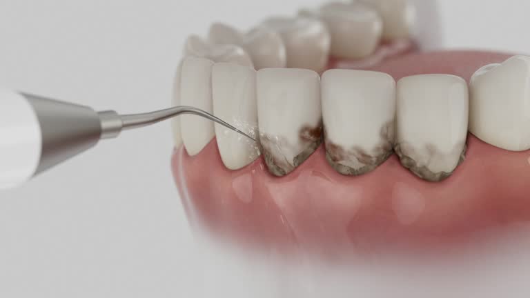 Reliable Teeth Cleaning And Checkup contractor in Calhoun County County, WV by Dentist Open Now